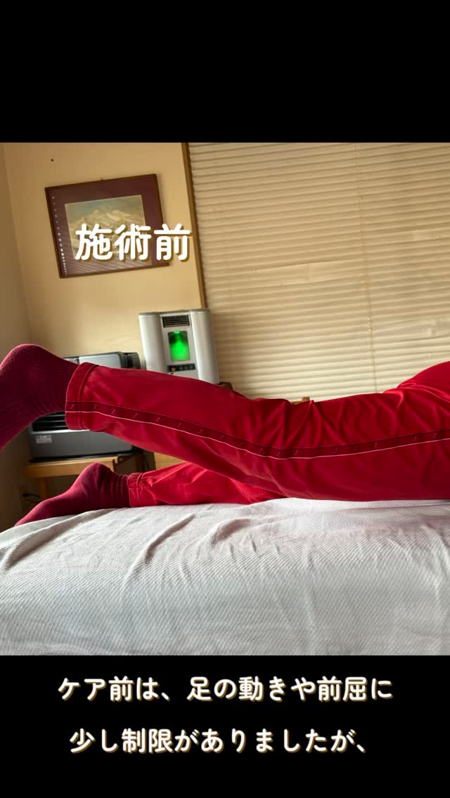 CS60ケア前と後の変化🌿