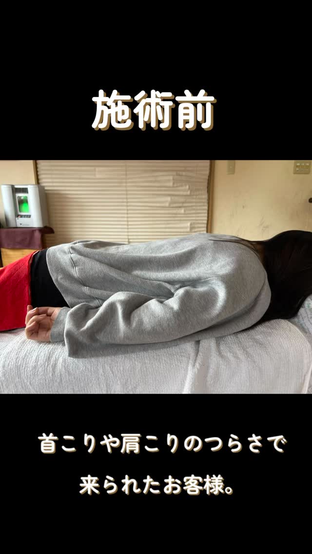 首こりや肩こりのつらさで来られたお客様。